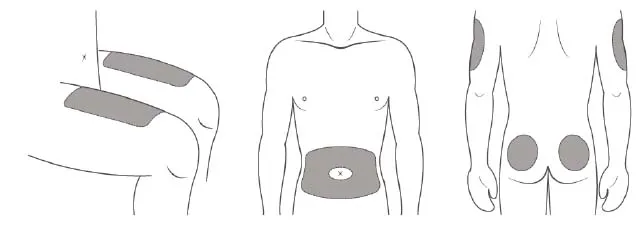 Use a different injection site for each injection Illustration